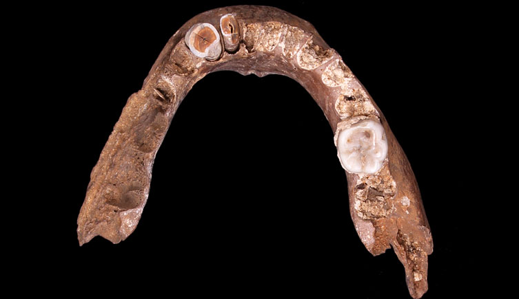 Mandible of adult excavated from Walthamstow Reservoir