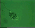 View Vorticella striata QuickTime movie - 2.012 mb