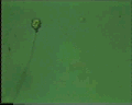 View Vorticella striata QuickTime movie - 2.159 mb
