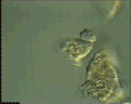 View Carchesium sp. QuickTime movie - 2.135 mb
