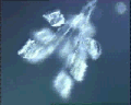 View Carchesium polypinum QuickTime movie - 2.715 mb