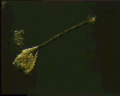 View Vorticella convallaria QuickTime movie - 0.737 mb