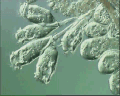 View Epistylis chrysemydis QuickTime movie - 0.41 mb