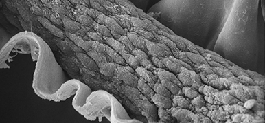 SEM image of hair