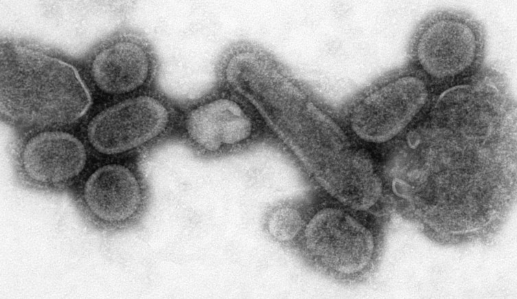 A negative stained transmission electron microscopic (TEM) image showing recreated 1918 influenza virus particles