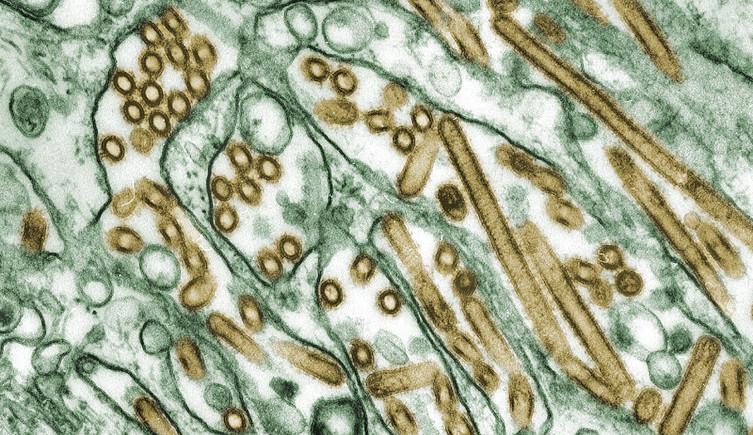 Colouriseed transmission electron micrograph of Avian influenza A H5N1 viruses