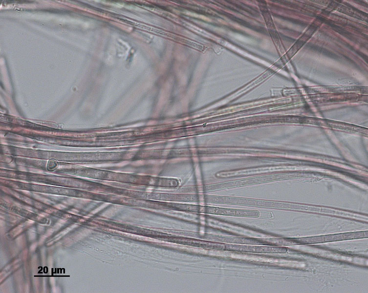 Bacteria under a microscope.