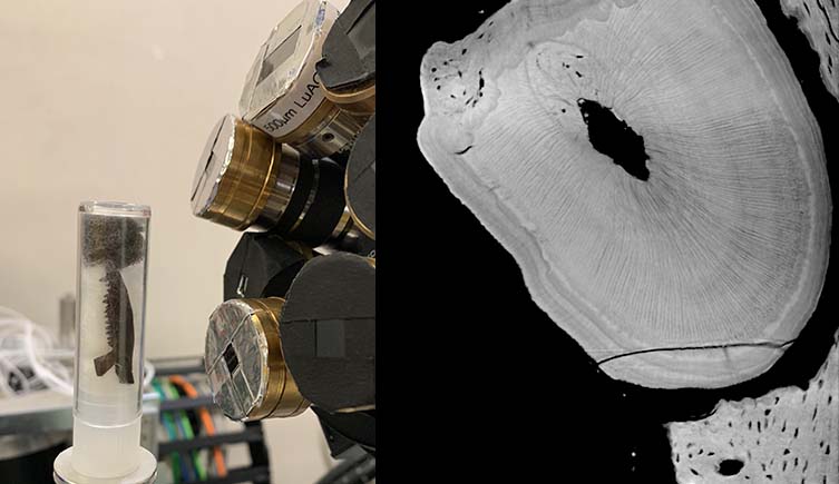 Left - a mammal jaw ready for scanning. Right - a scan of a fossil tooth showing clear rings.