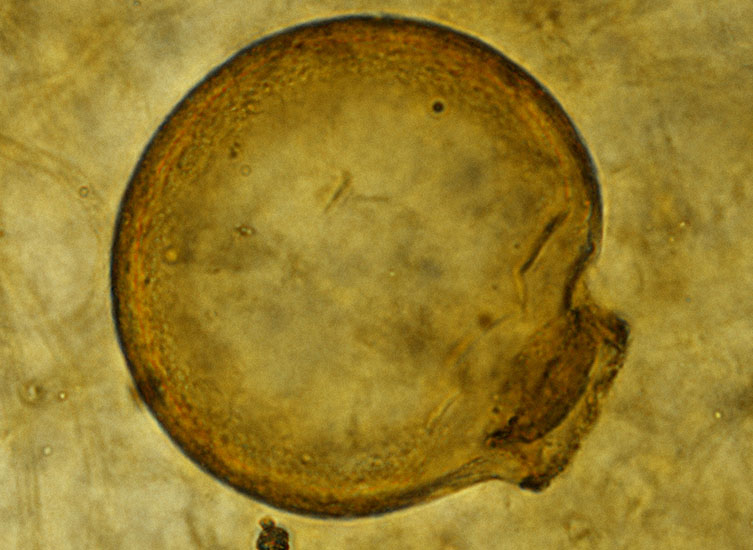 Testate amoebae fossil