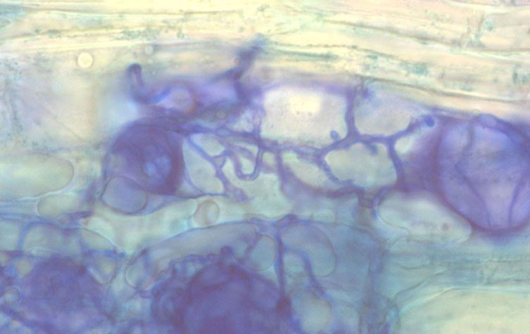 A microscope image of clover root cells colonised by fungus