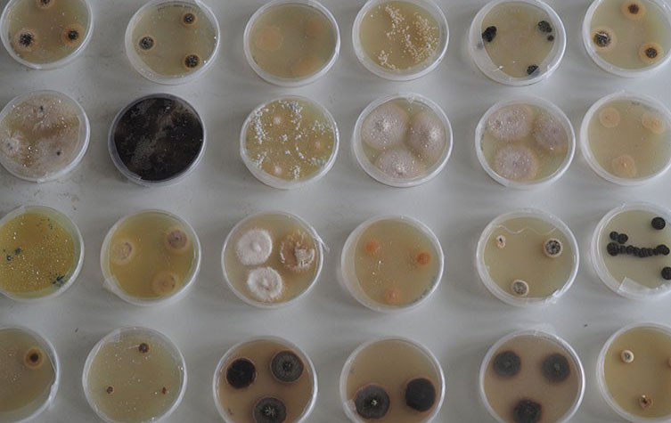 Different types of fungi growing in an array of petri dishes