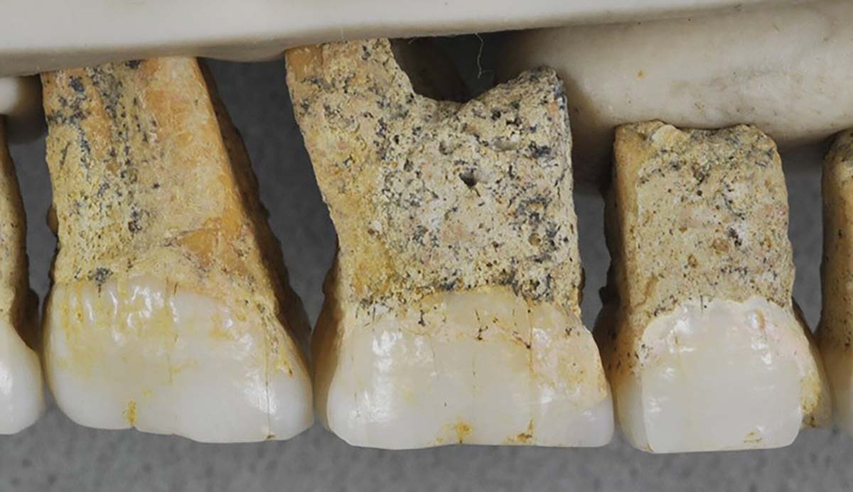 A photograph of several Homo luzonensis teeth.