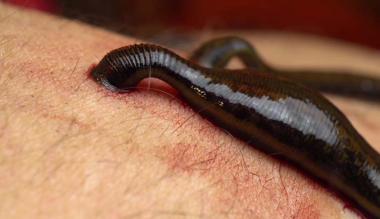 Two black leeches suck blood from a human arm.