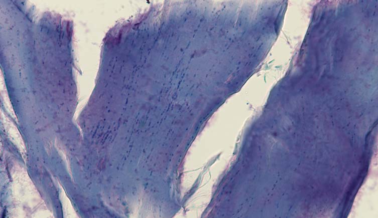 A slice of the mammoth's muscle under a microscope, showing the remnants of cell nuclei.