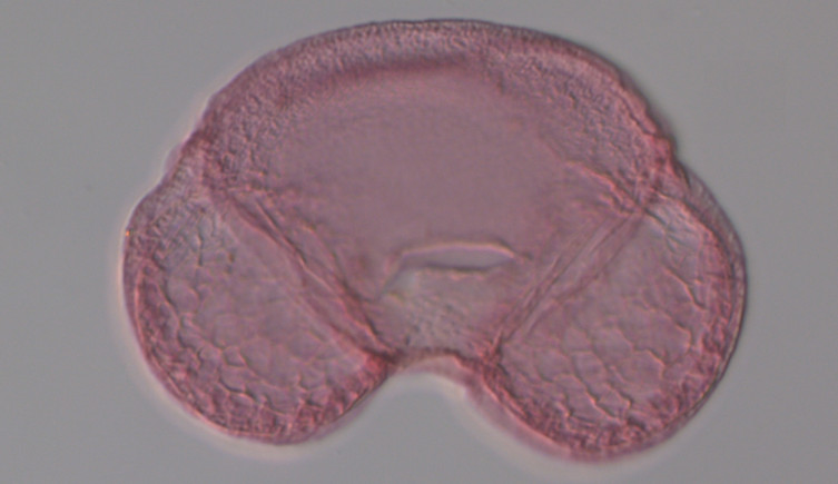 An photograph taken under a microscope of an eastern white pine pollen grain