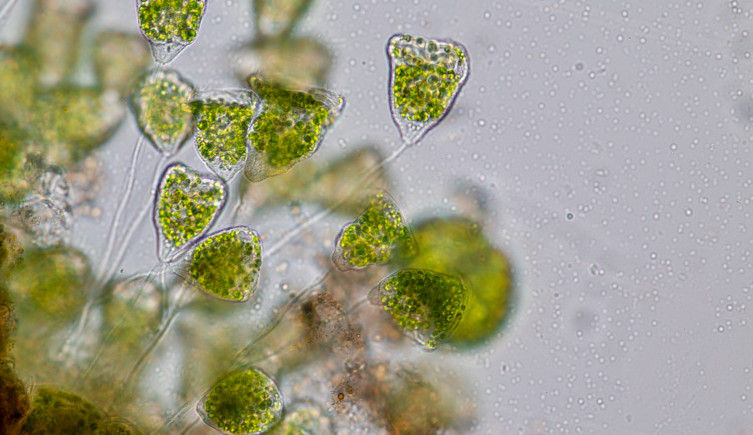 A group of single-celled Vorticella, looking like bells on top of stalks, seen under a microscope