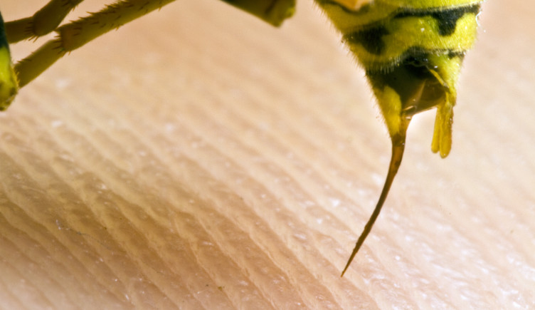 A wasp sting just above the skin of a human.