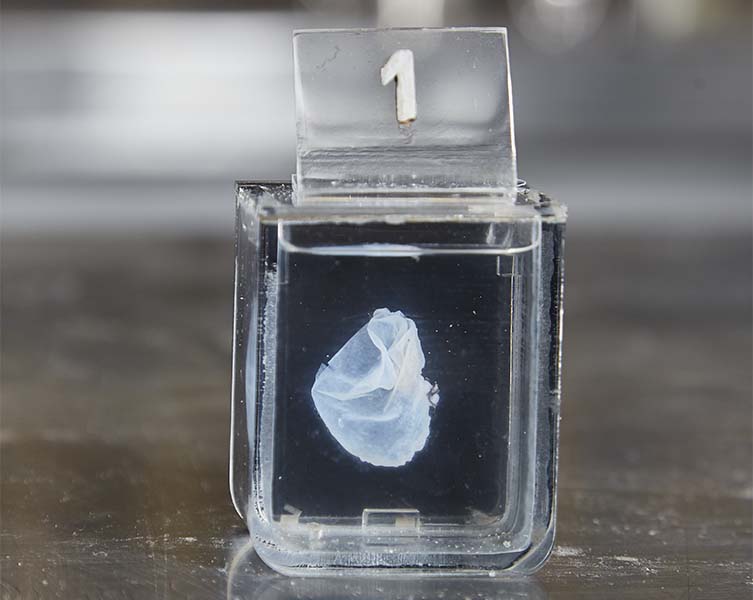 A small jar full of clear liquid, with a label reading "1". The specimen inside is a very early stage humpback whale foetus. 