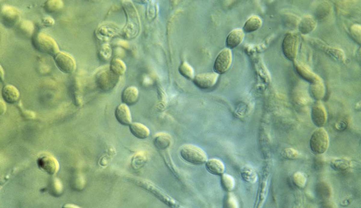 Green cyanobacteria pictured under the microscope.