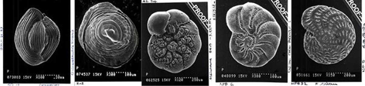 Five microscopic images each containing a single-celled Foraminiferal