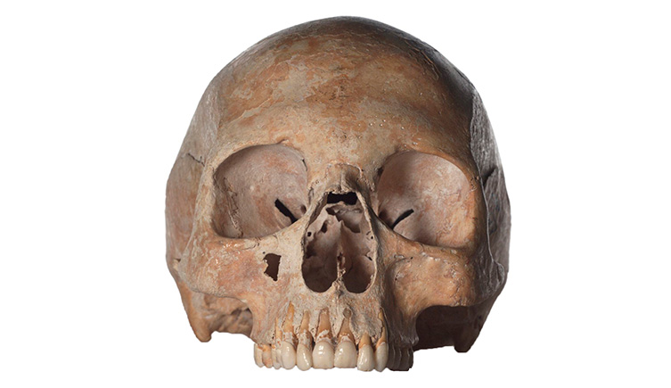 Human skull.