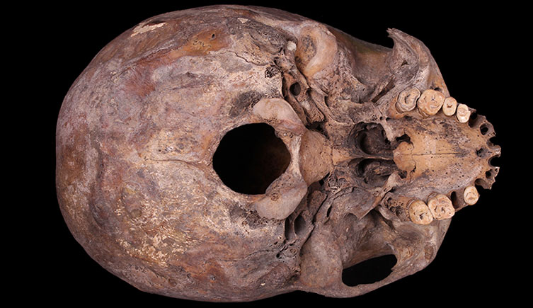 Cranium of an adult female with relatively advanced dental wear 