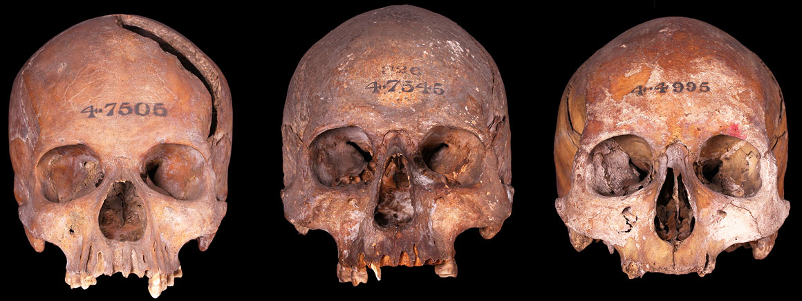 Crania of unknown date from London 