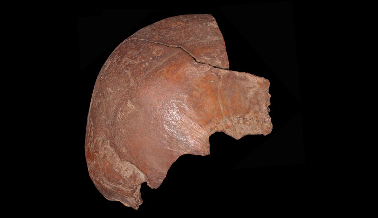 View of the right side of the cranium of adult from King Street