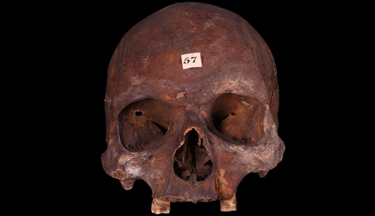 Cranium of an adult male excavated from a site in Commercial Street