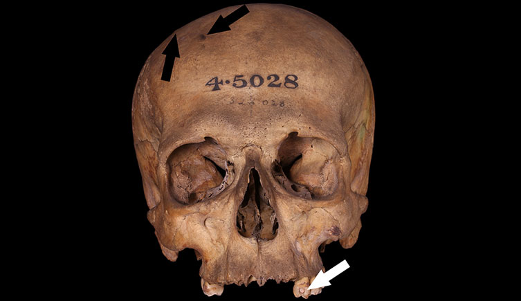 Cranium of a young adult male