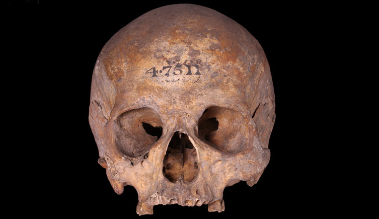 Cranium of an adult male excavated near Minories 