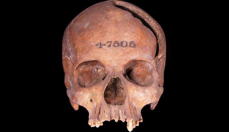Cranium from Bishopsgate