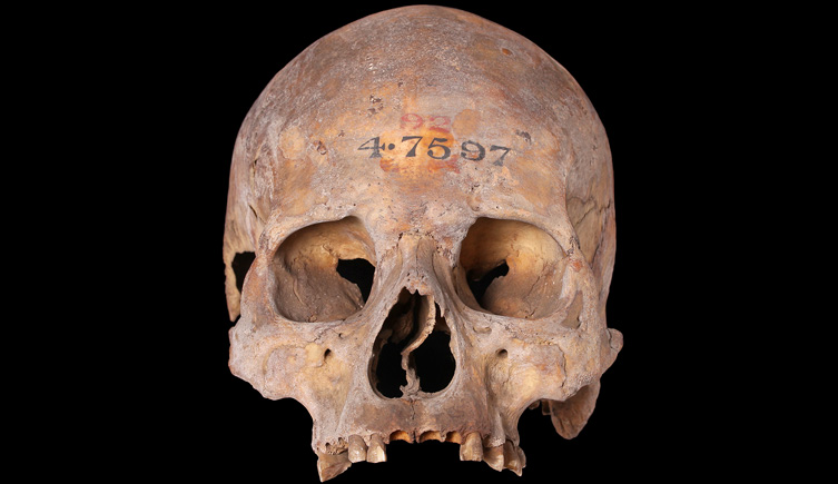 Cranium from St Paul'’s Churchyard