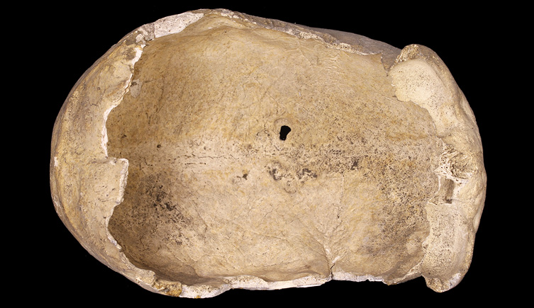 Endocranial surface of incomplete cranium from Lewisham