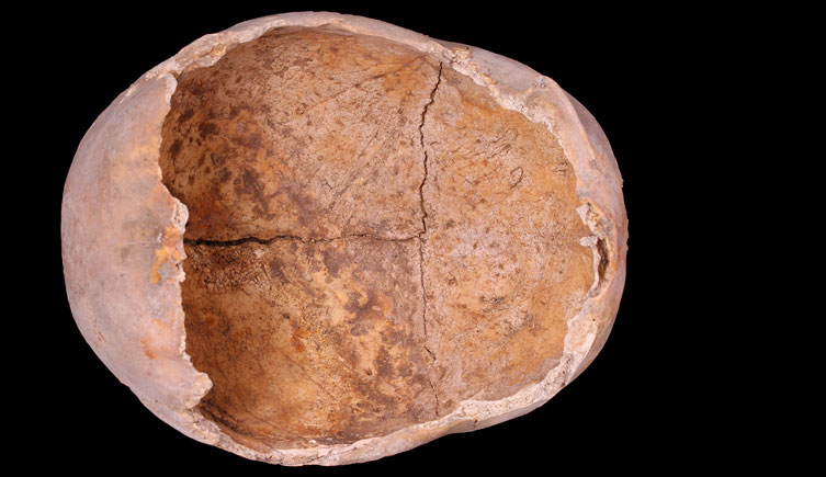 Incomplete cranium from St Dunstan’s-in-the-East