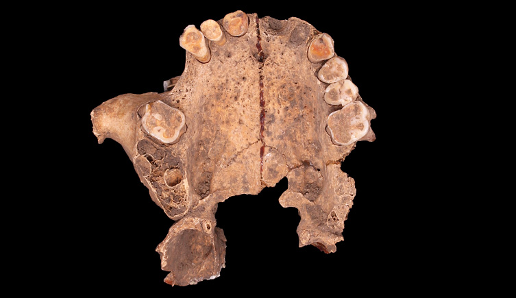 Maxilla with extensive tooth wear from Smithfield
