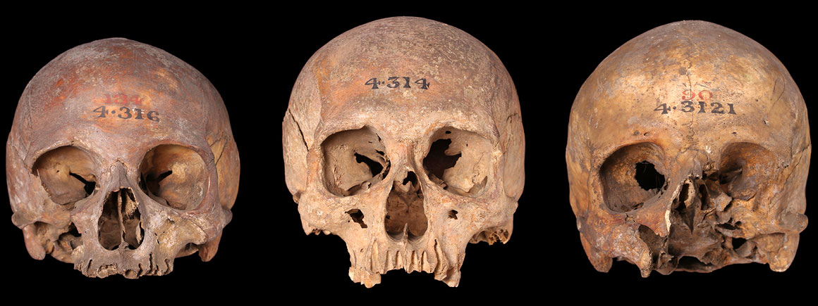 Medieval crania from London