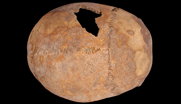 Cranium of adult male with active porosity