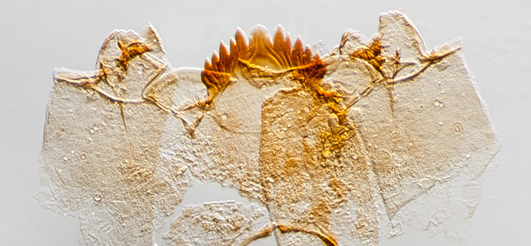 Microscope view of Dicrotendipes, a species of non-biting midge.