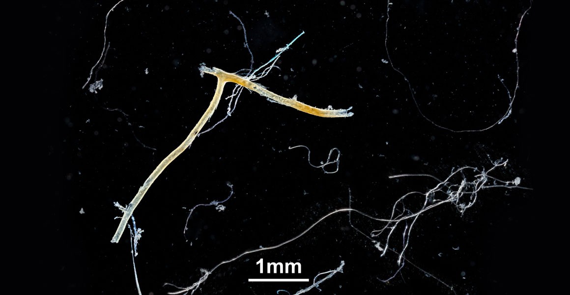 An extreme close up of microplastic textile fibres