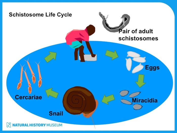 schistosomiasis zanzibar