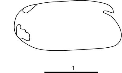 Outline of Archiconchoecetta  gastrodes