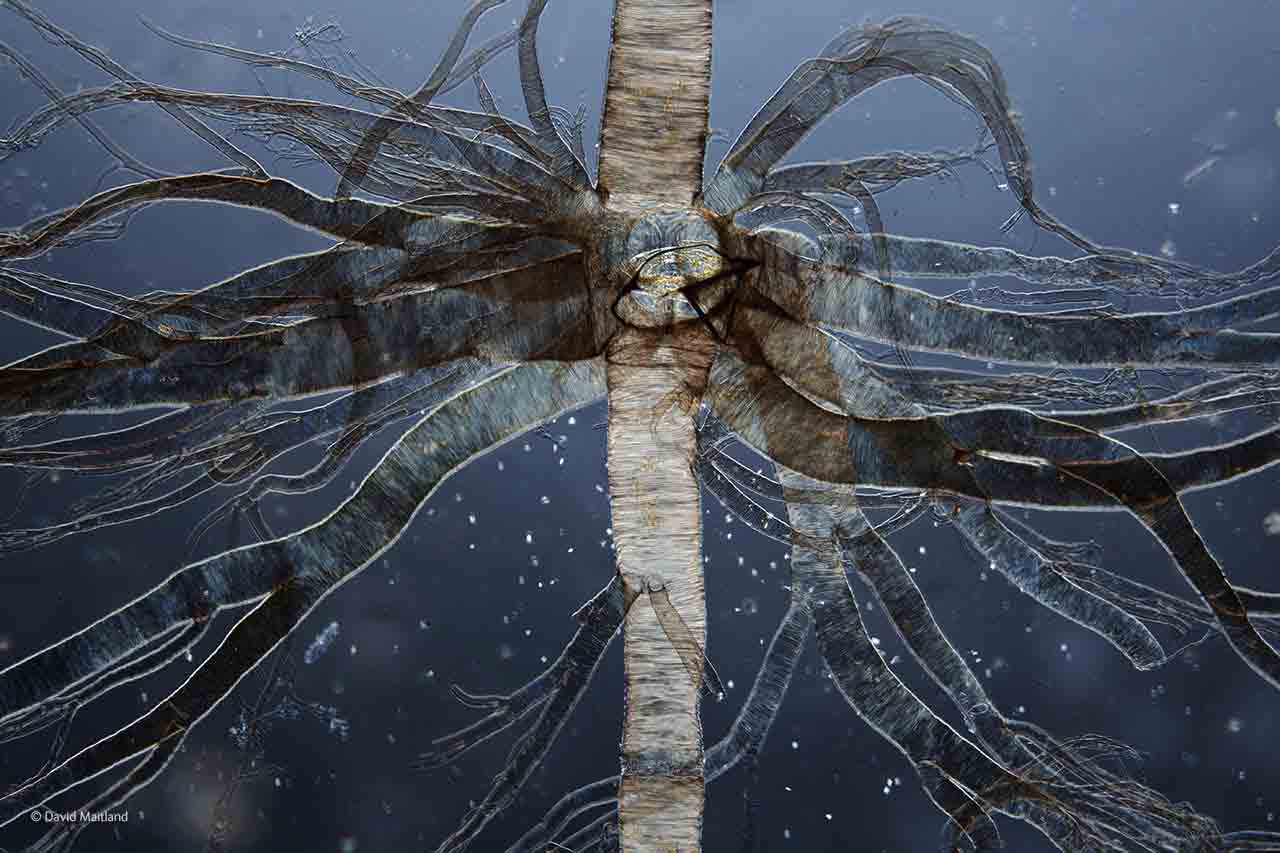 The tracheal tree